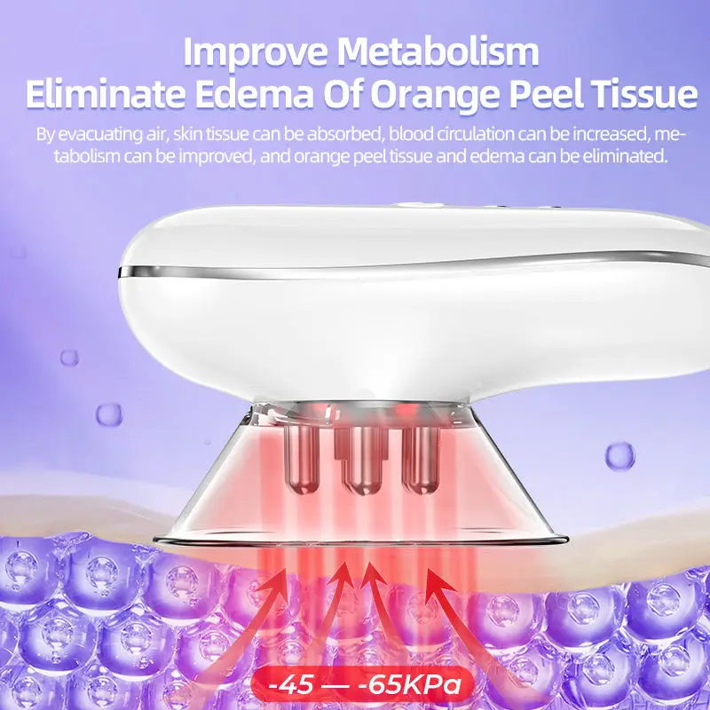 Anti-Cellulite Massager – Smoother and Firmer Skin at Home - Image 3